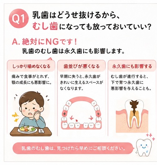 乳歯のむし歯について
