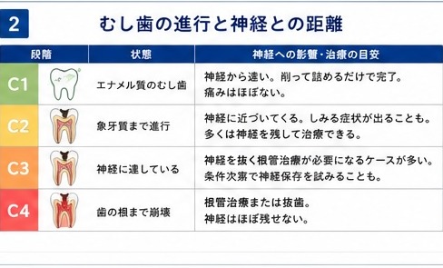 ②むし歯の進行と神経との距離