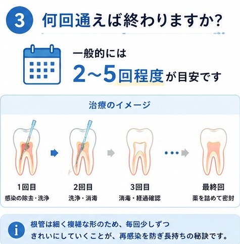 何回通えば終わりますか