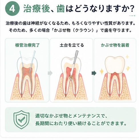治療後、歯はどうなりますか